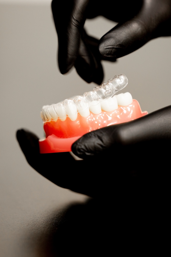 Clear aligner fitted over a dental model, held in black-gloved hands
