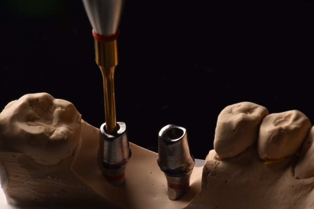 Custom abutments being seated on a plaster model with a driver