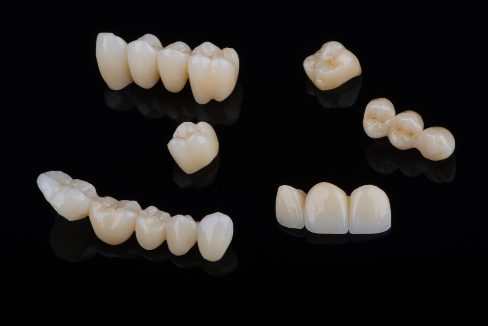 Zirconia crowns and bridges arranged on a black surface