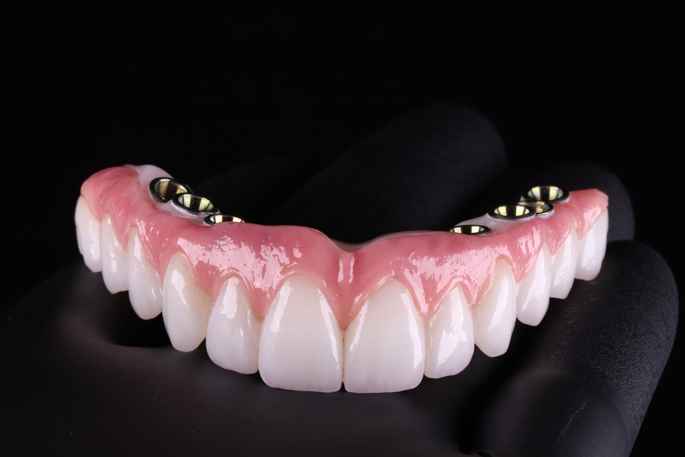 Full-arch zirconia implant prosthesis held in black-gloved hands