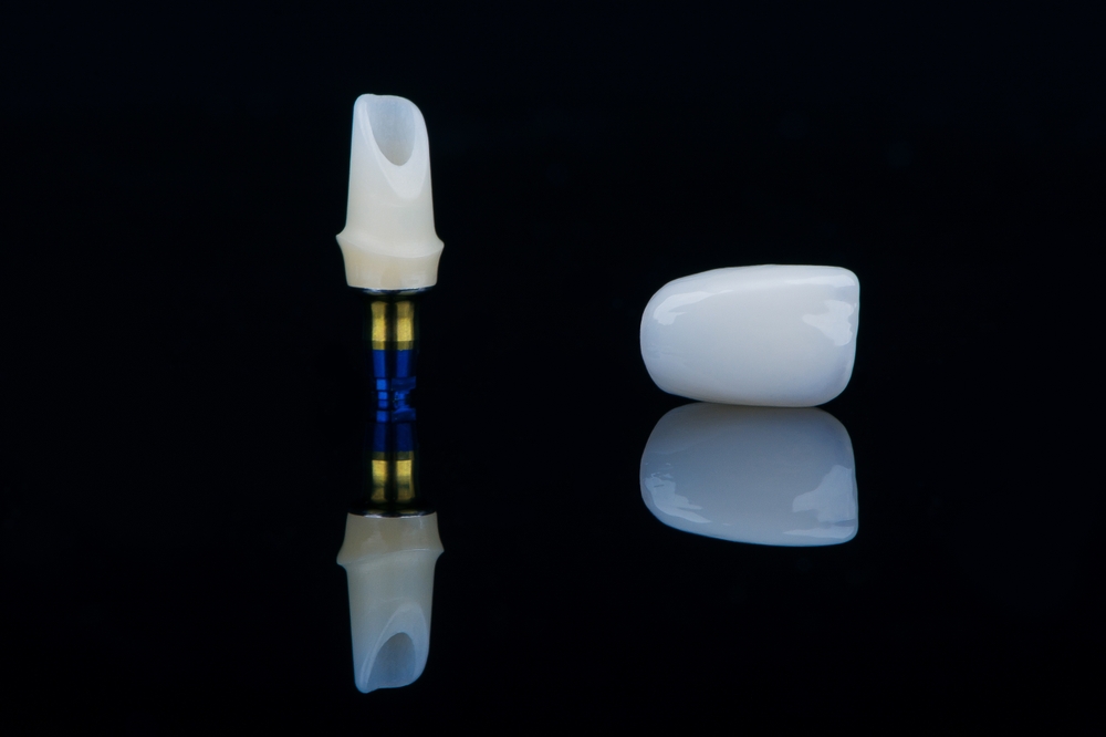 Custom abutment and implant crown on a black background