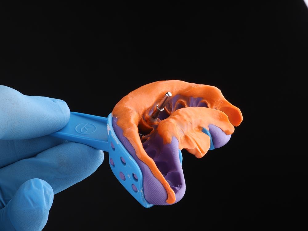 Silicone impression in a tray held in a gloved hand