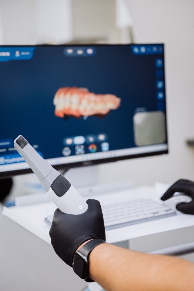 Intraoral scanner in front of a monitor showing a digital model
